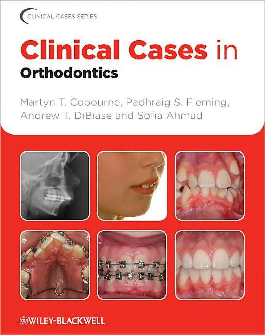 Clinical Cases in Orthodontics, Paperback by Cobourne, Martyn T.; Fleming